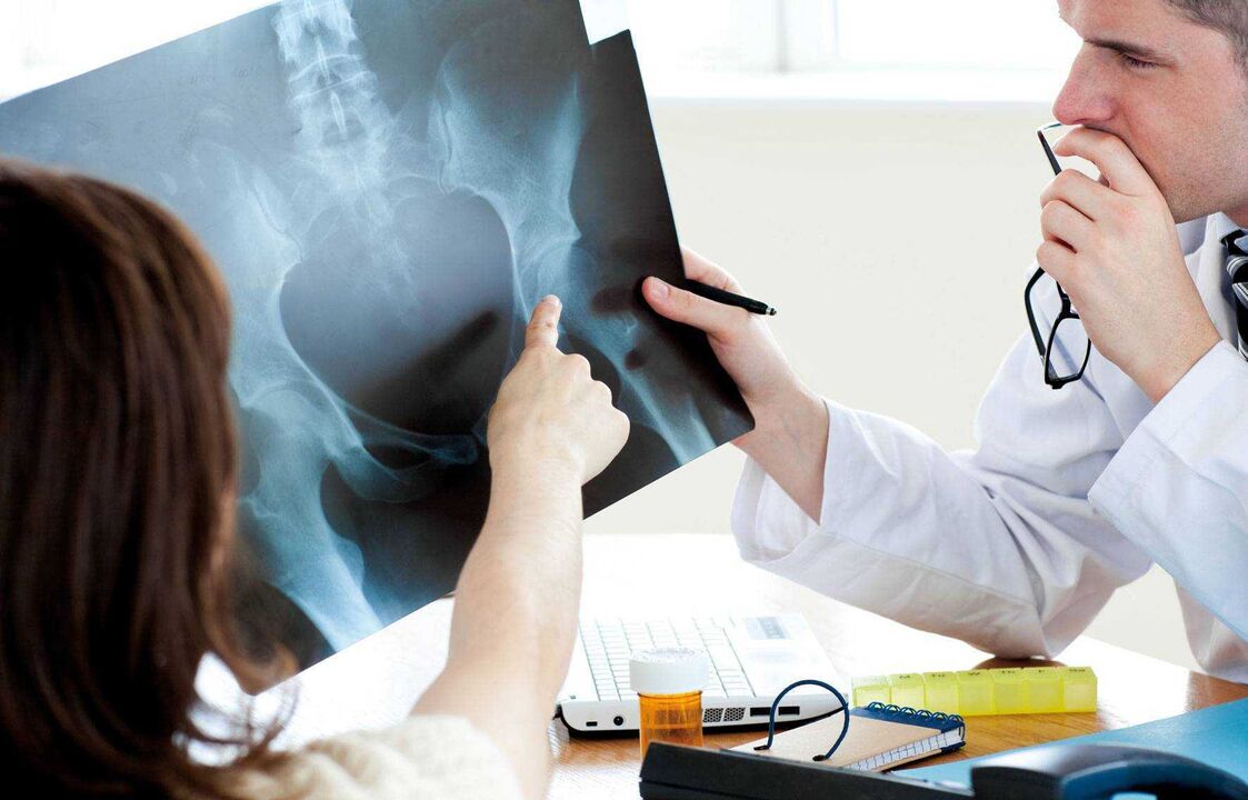 kalça artrozu için röntgeni inceleyen doktorlar