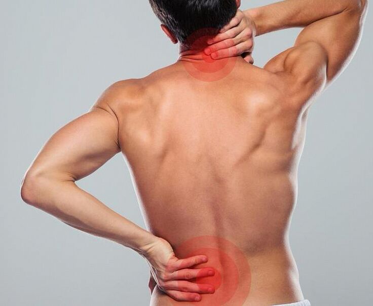 Bir erkeğin spinal osteokondrozu vardır